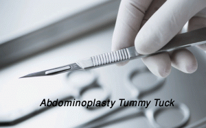 Abdominoplasty Tummy Tuck Instruments Set